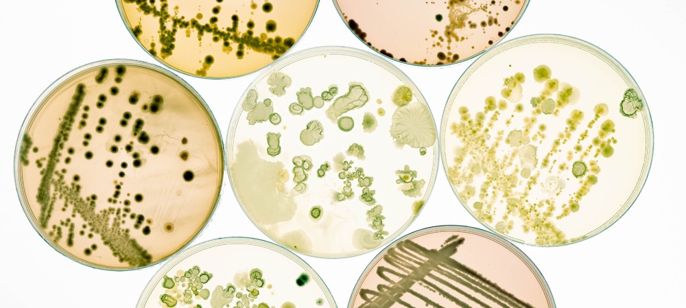 muestras de microorganismos y bacterias