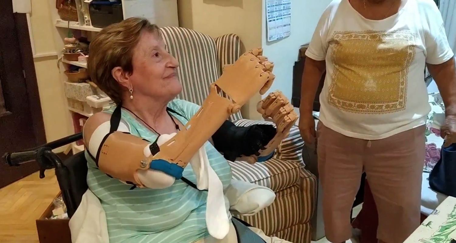 Consolación and her 3D prosthetic arm